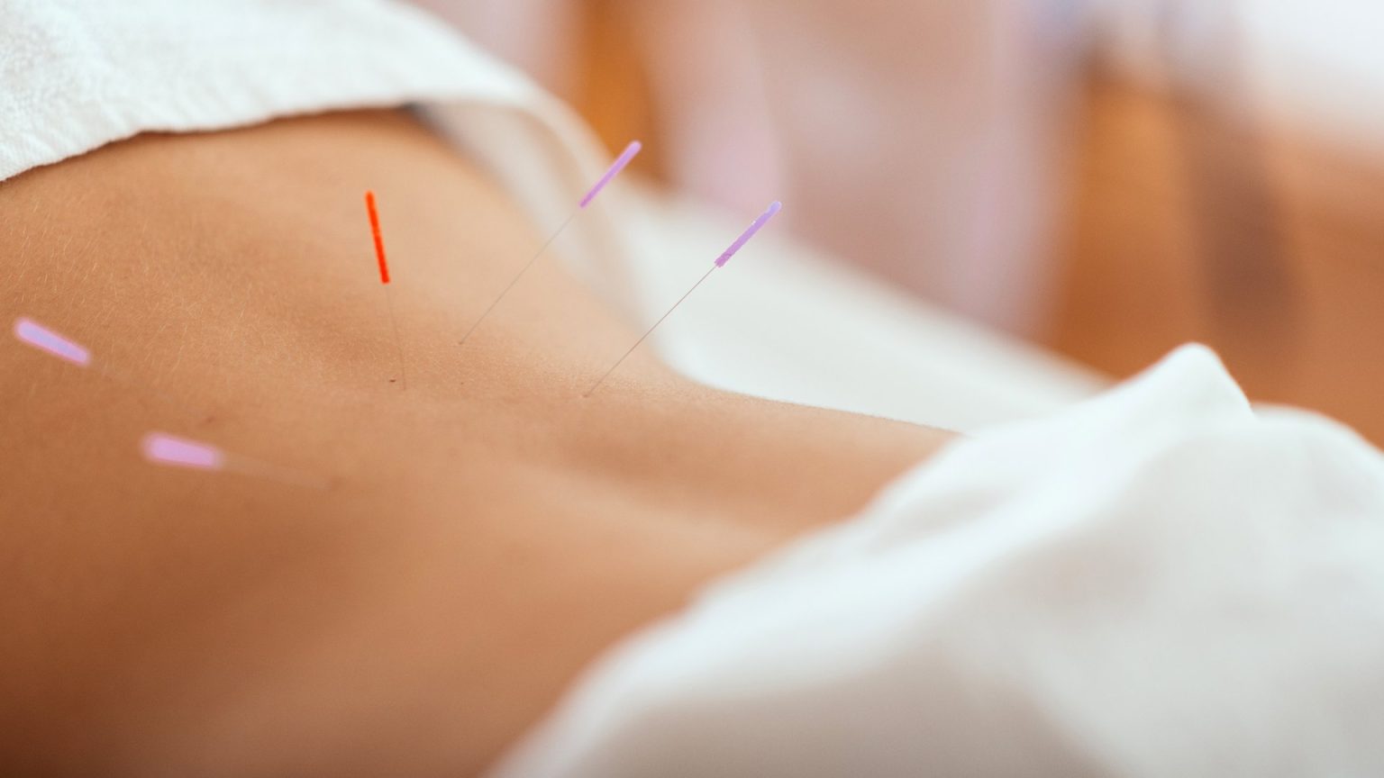 Acupuntura para el equilibrio energético